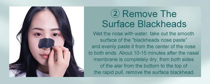 Blackhead Pore Vacuum Cleaner Whitehead Extractor Kit