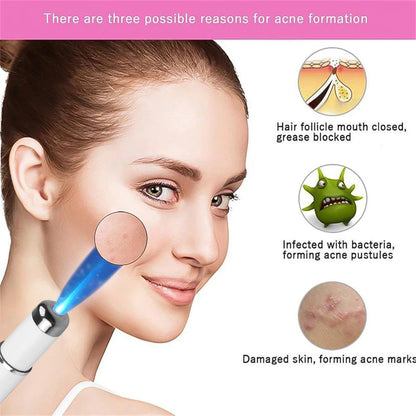 Ultra Blue Light Laser Acne Removal Pen