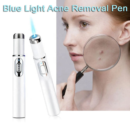 Ultra Blue Light Laser Acne Removal Pen