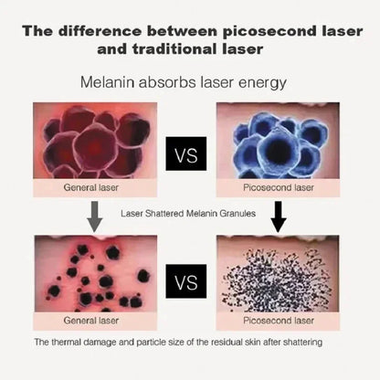 Picosecond Laser Professional Tattoo Removal Machine