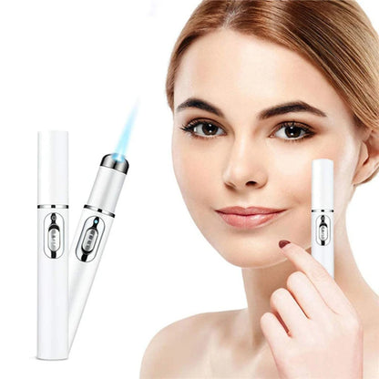 Ultra Blue Light Laser Acne Removal Pen