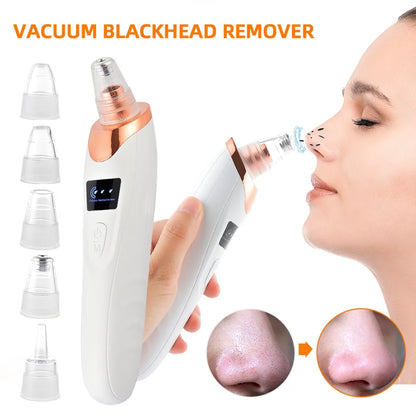 Elite Blackhead Suction Vaccum Extractor