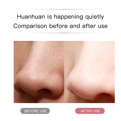 Ultrasonic Face Scraper