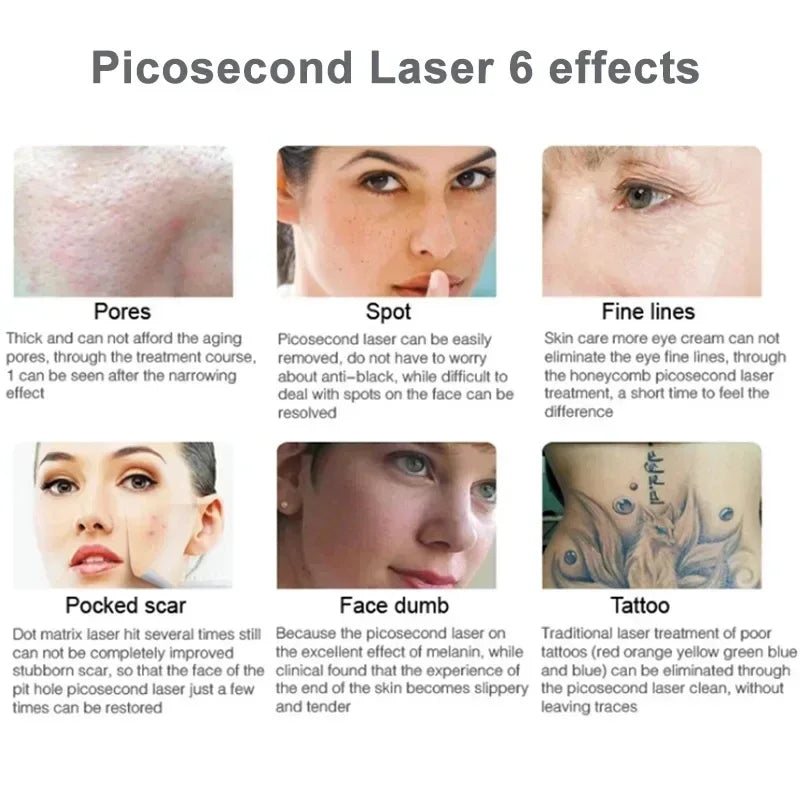 Picosecond Laser Professional Tattoo Removal Machine